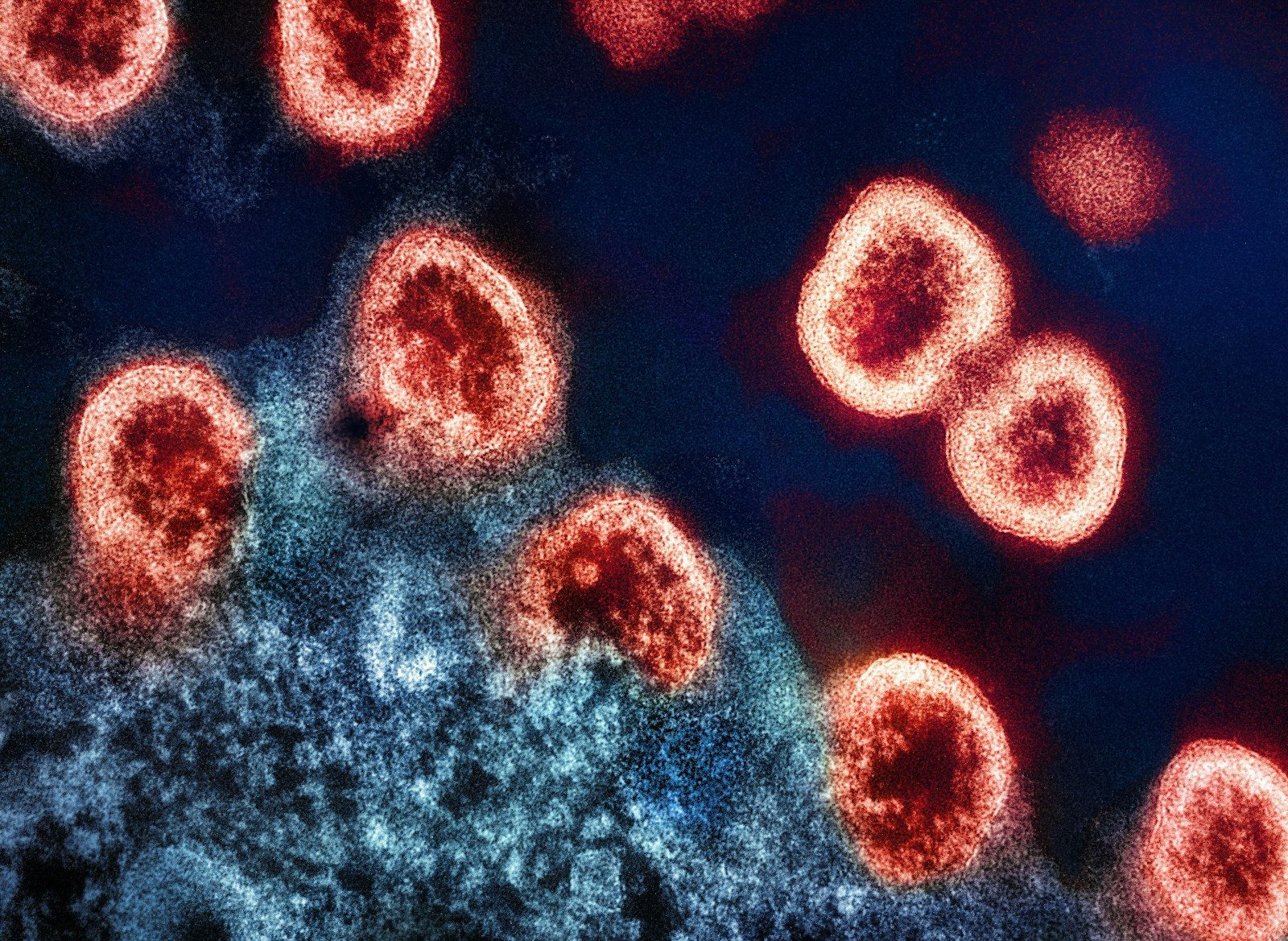 Autoimmune Disease